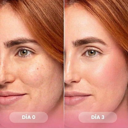 Mascarilla Bio - Colágeno – Reduce las arrugas después de una sola aplicación - Lumera Skin