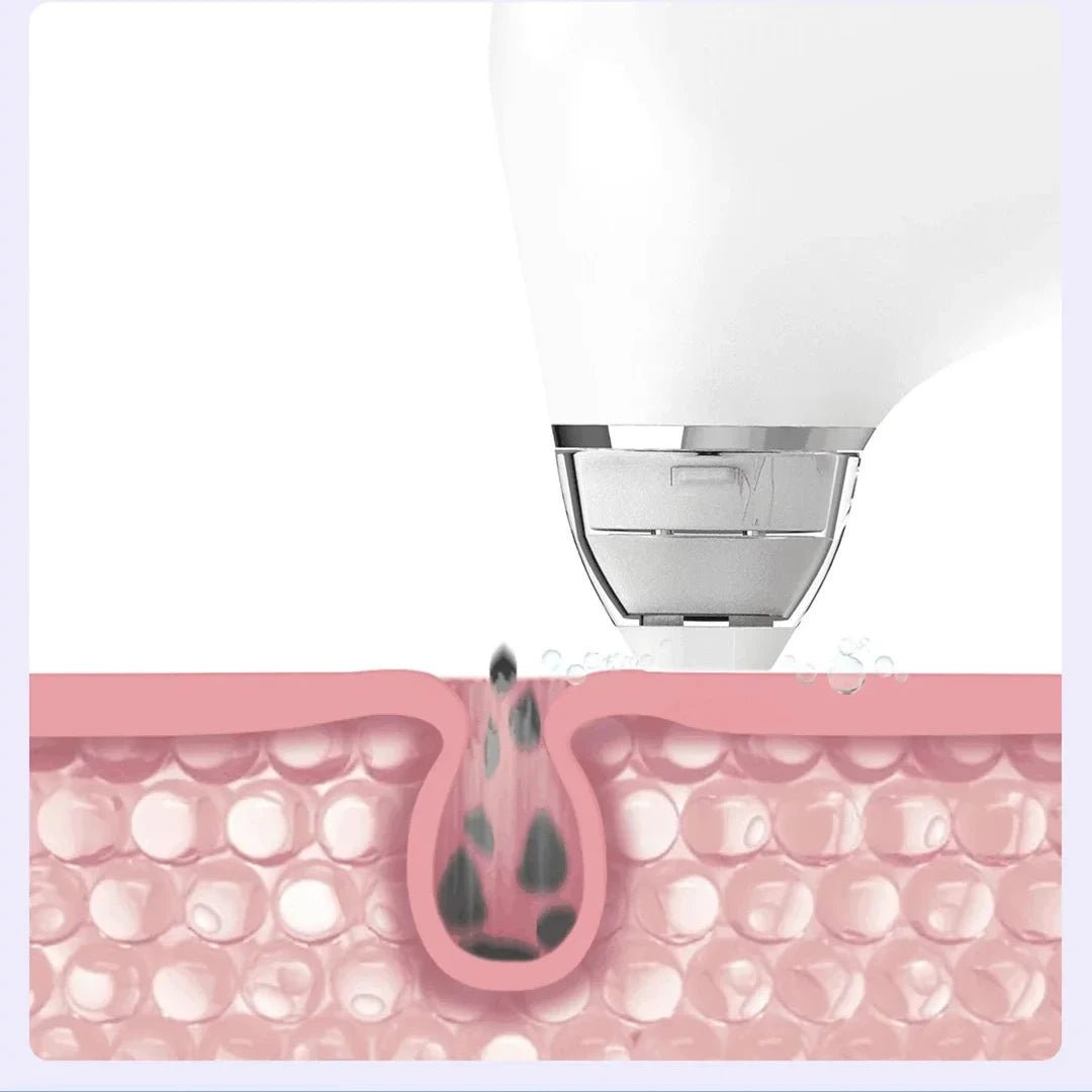 PoreVac Elite Skin Cleanser - Lumera Skin